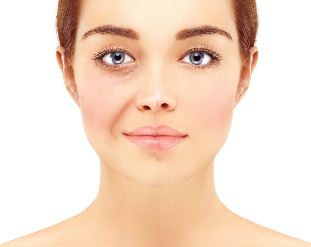 chirurgie-visage-lipostructure-docteur-jorquera-montpellier